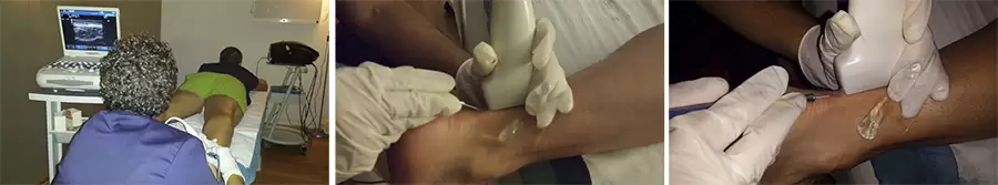 Electrólisis Percutánea Intratisular