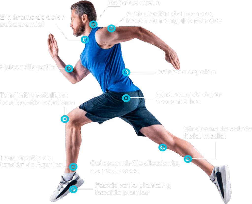 fisioterapia en santurce