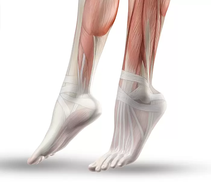 Fasciopatía plantar y Fascitis plantar
