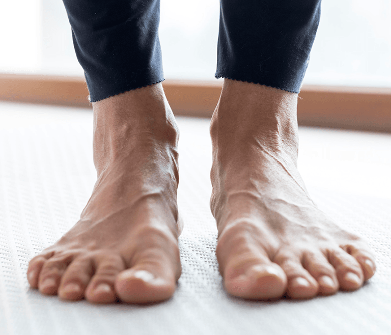 pie plano o pie cavo